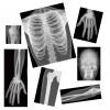 Der Mensch - Röntgenbilder